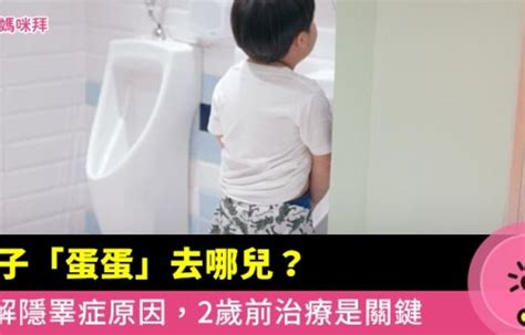 隱澤症|甚麼是隱睪症？需要急於為孩子做手術嗎？ 